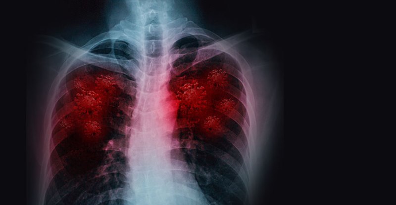 Promising COVID-19 therapeutic drug to start phase 3 clinical trial in the United States - Vimarsana News