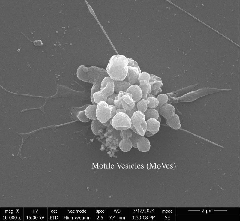 Image of a motile vesicle (MoVe) obtained by scanning electron microscopy (SEM).