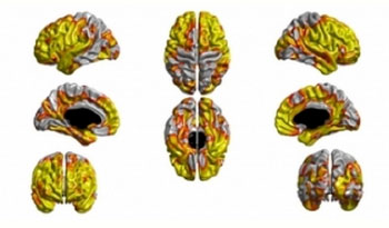 Smoking thins vital part of brain