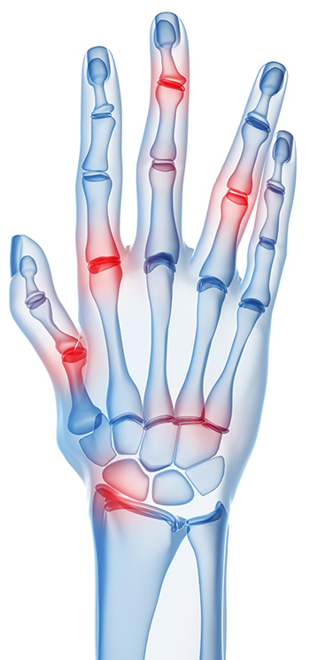 Division of Rheumatology | McGill University Health Centre