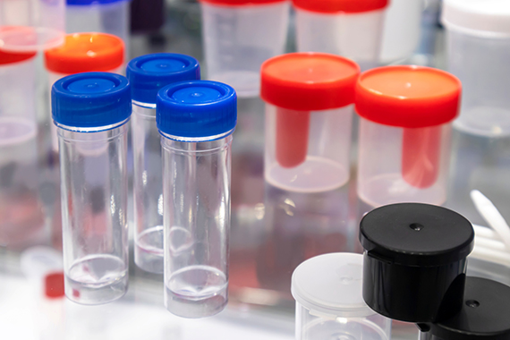 Greener laboratories: reusing plastic instruments instead of throwing them away