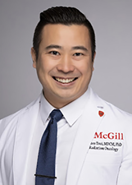 A clinical trial to reduce treatment for prostate cancer