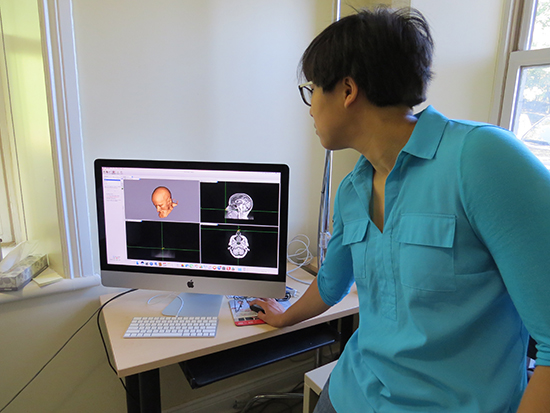 Images of Betty's brain are shown on a computer screen and are used to guide researchers for the placement of the coil on her head to give the rTMS procedure in the targeted areas.