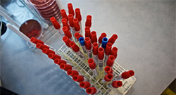 RI-MUHC discovery could improve the treatment of several cancers