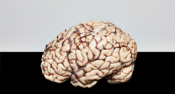 Brain