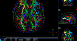 Neuroscience