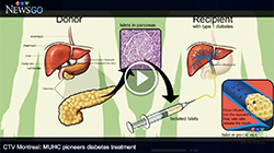 MUHC conducts first islet cell transplant in Quebec