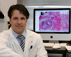 Dr. Lorenzo Ferri, MUHC director of the Division of Thoracic Surgery and the Upper Gastrointestinal (GI) 